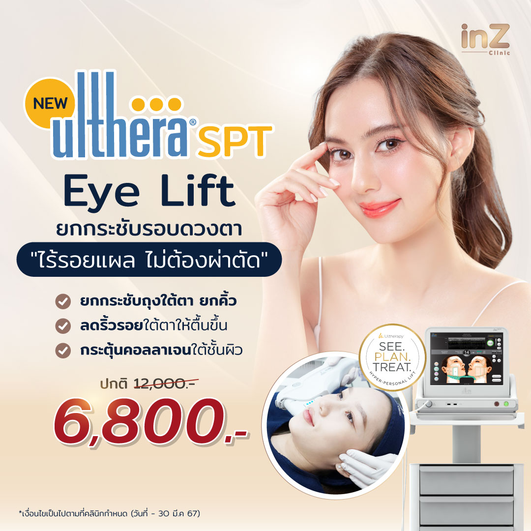 Ulthera-Eye-Lift