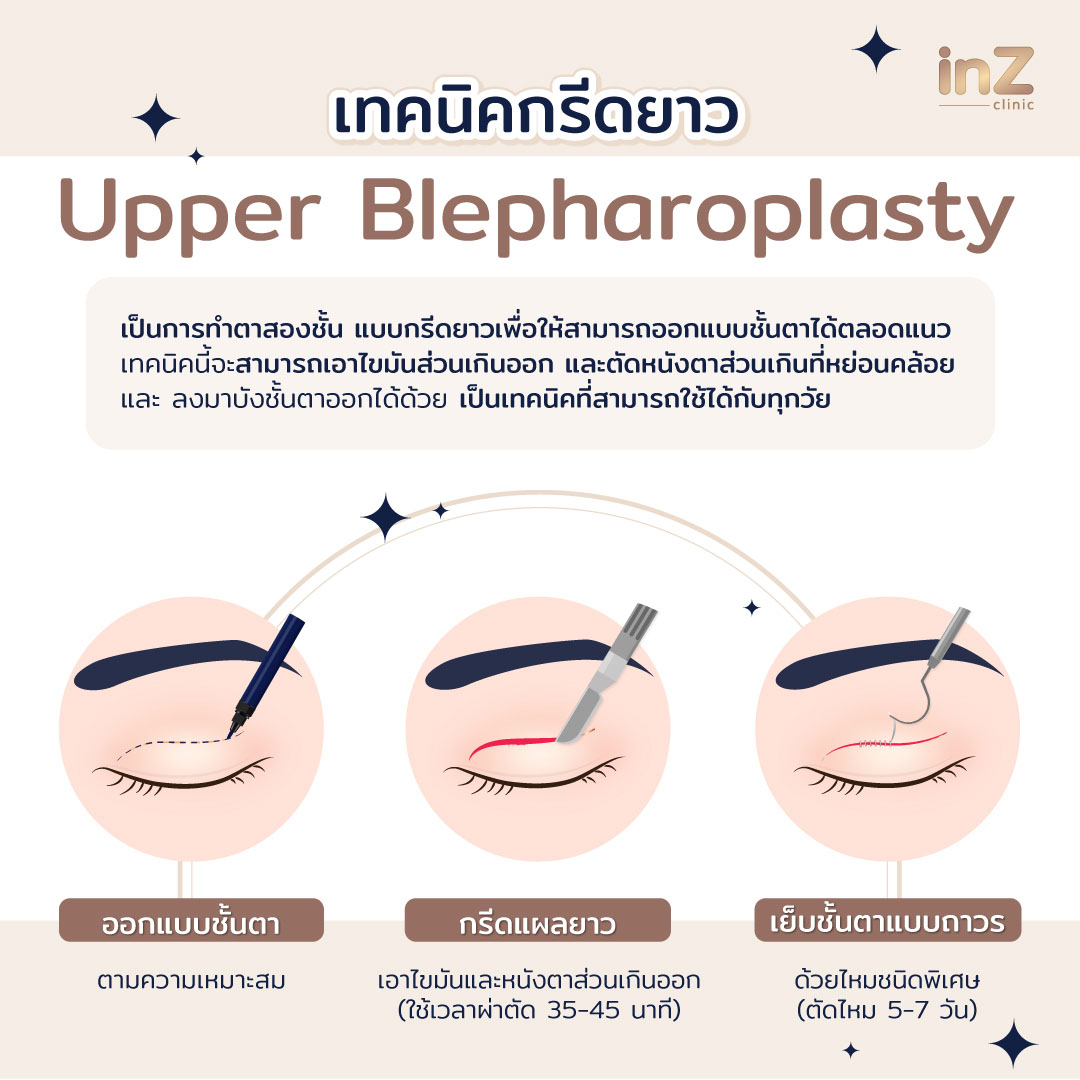 ทำตาสองชั้น แก้ไขหนังตาตก (Upper Blepharoplasty)