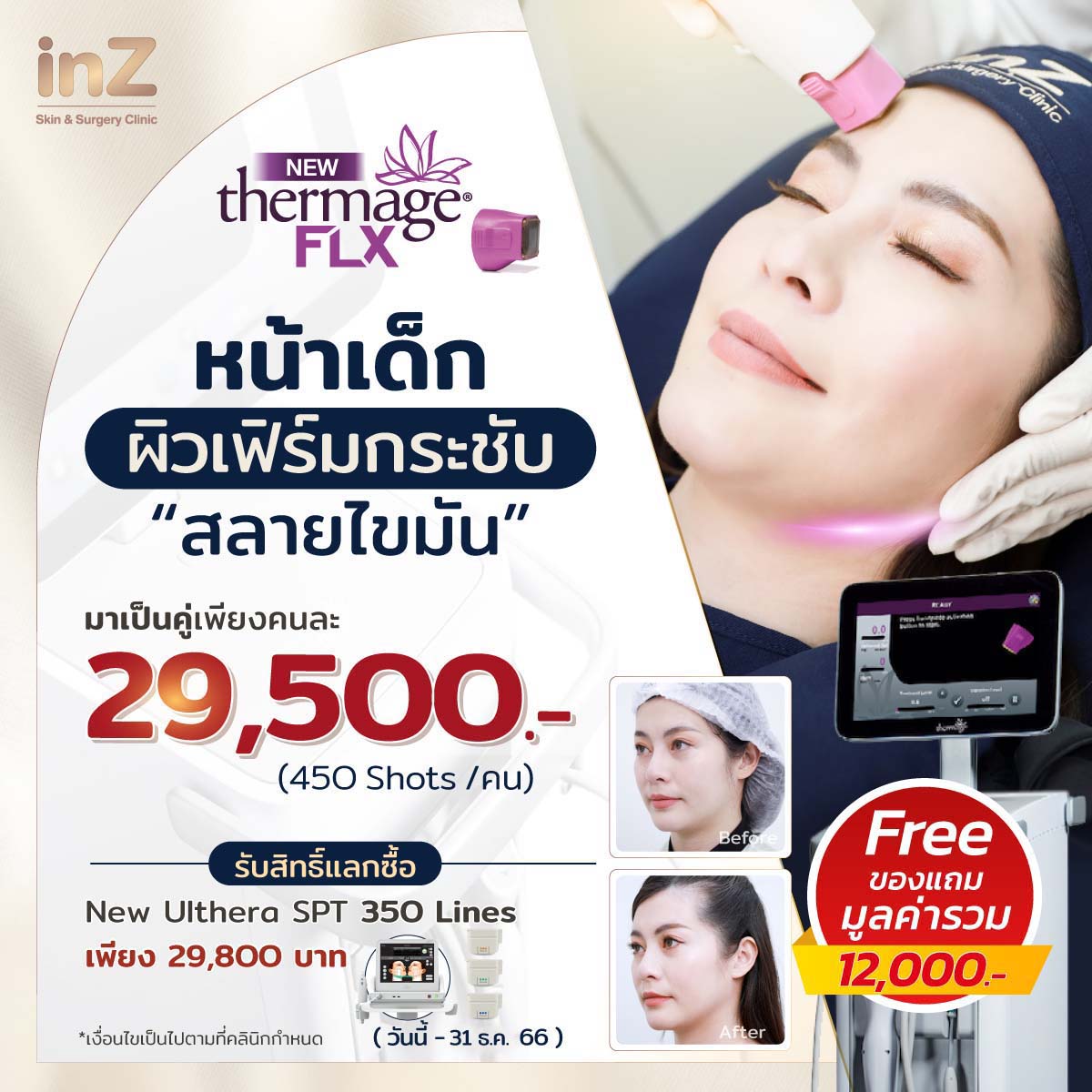 โปรโมชั่น Thermage