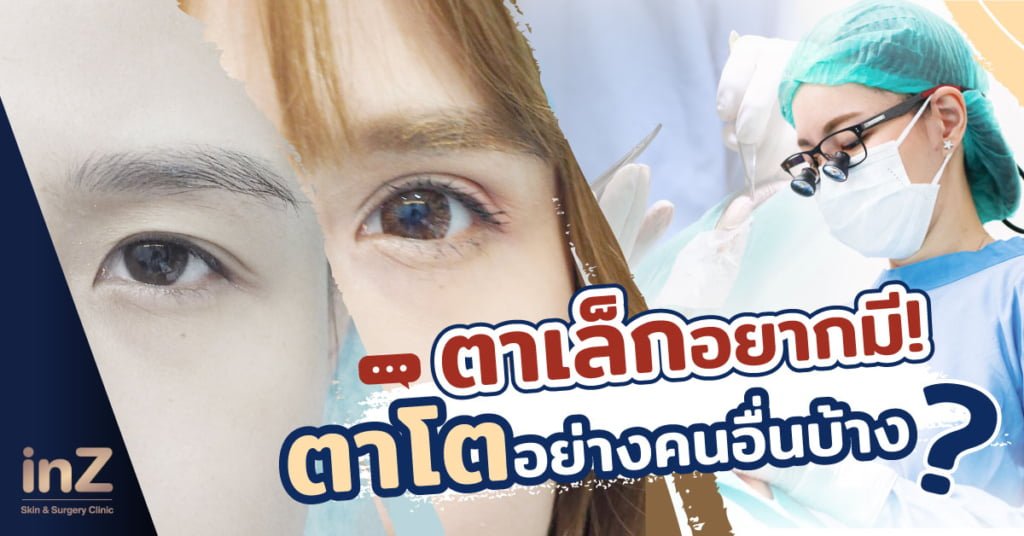 ตาเล็ก อยากมีตาโตกับคนอื่นเค้าบ้าง ทำได้ยังไง