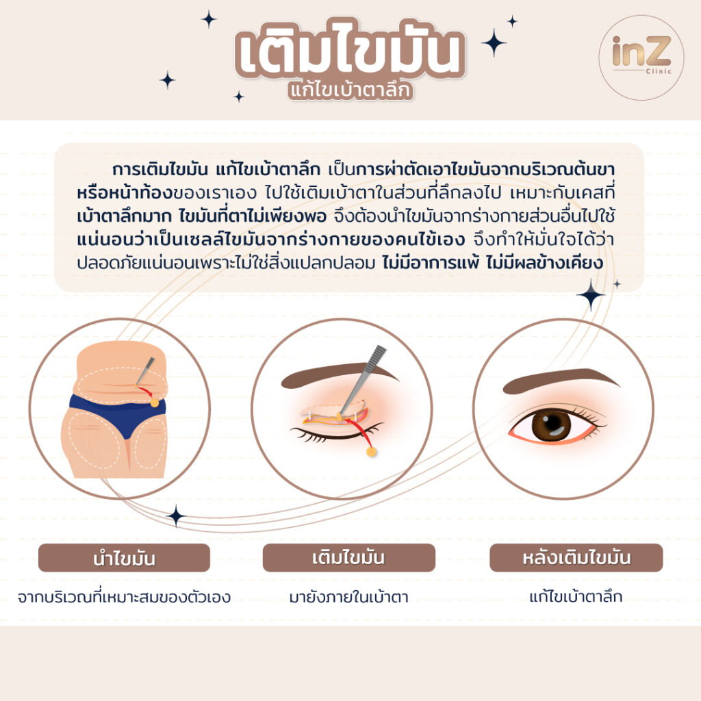 inZ Clinic ไขทุกข้อสงสัย