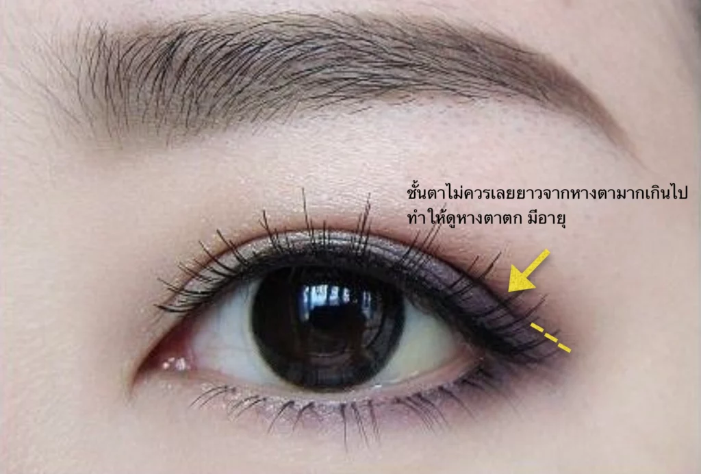 ลักษณะตาสวย_ชั้นตาไม่ควรยาวเลยหางตา_inzclinic