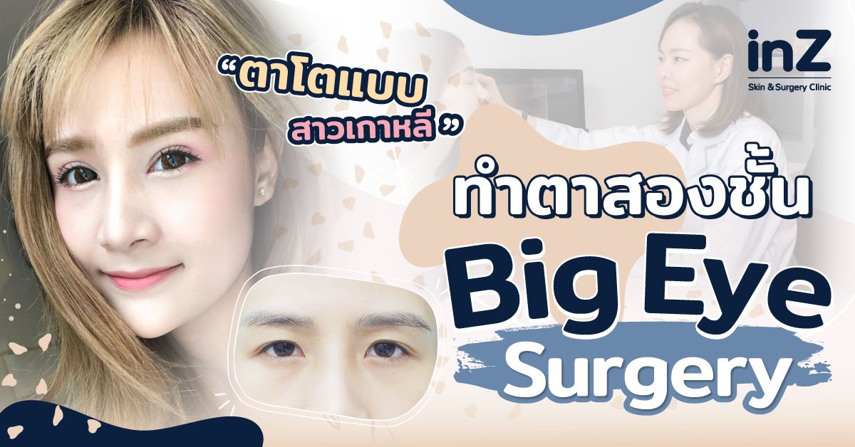 คนตาเล็ก ทำให้ตาโตขึ้นด้วย Big eye surgery แบบสาวเกาหลี - inZ Clinic คนตาเล็ก ทำให้ตาโตขึ้นด้วย Big Eye Surgery แบบสาวเกาหลี - Inz Clinic