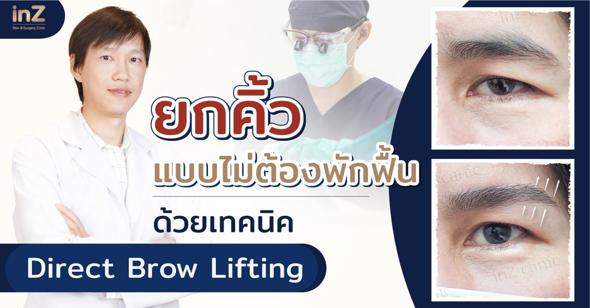 ยกคิ้วแบบไม่ต้องพักฟื้นด้วยเทคนิคDirect-Brow-lift