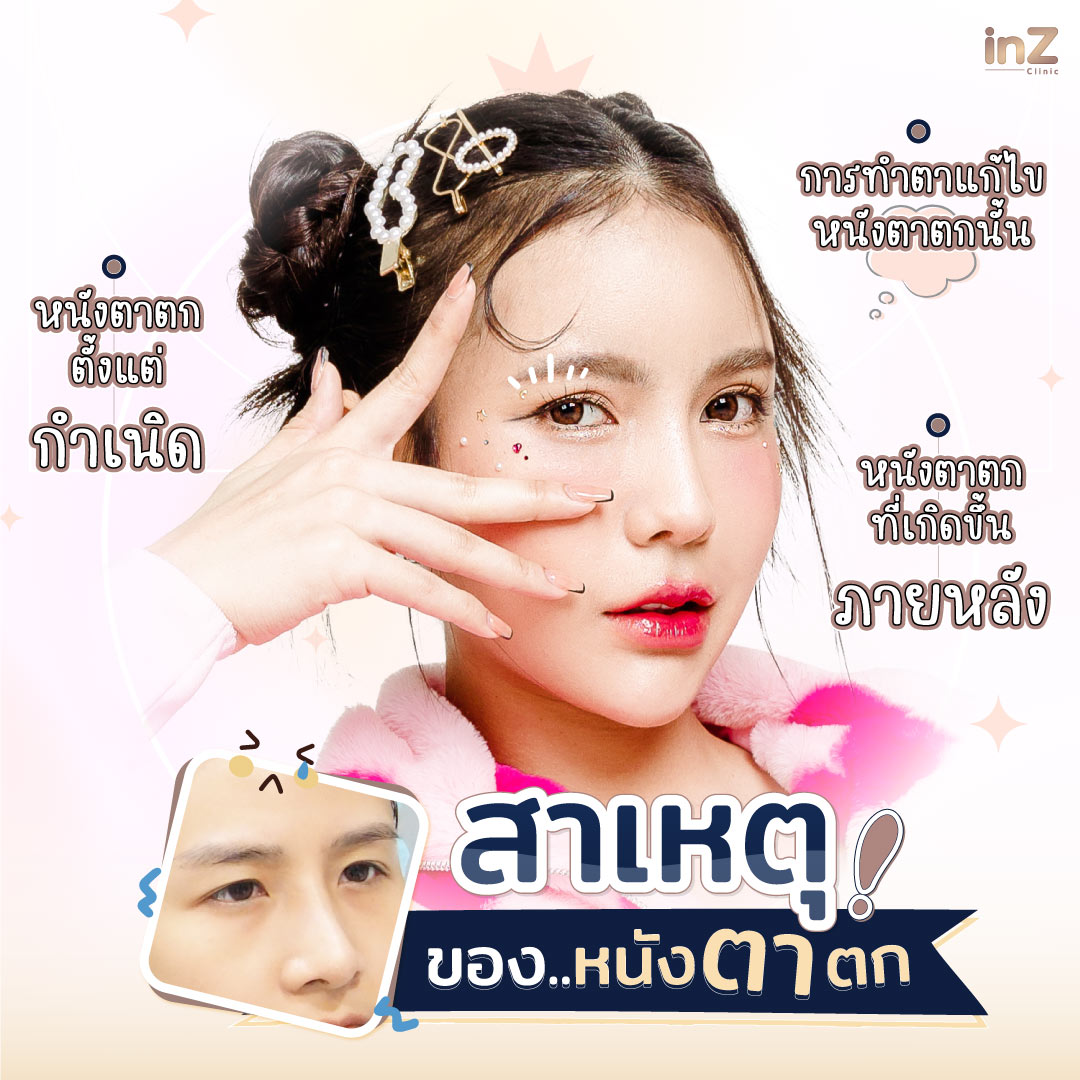สาเหตุของหนังตาตก