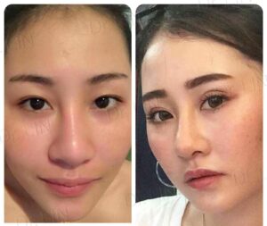 ตาชั้นเดียว