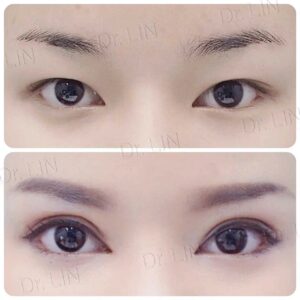 ตาชั้นเดียว