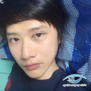 ทำตาสองชั้นผู้ชาย