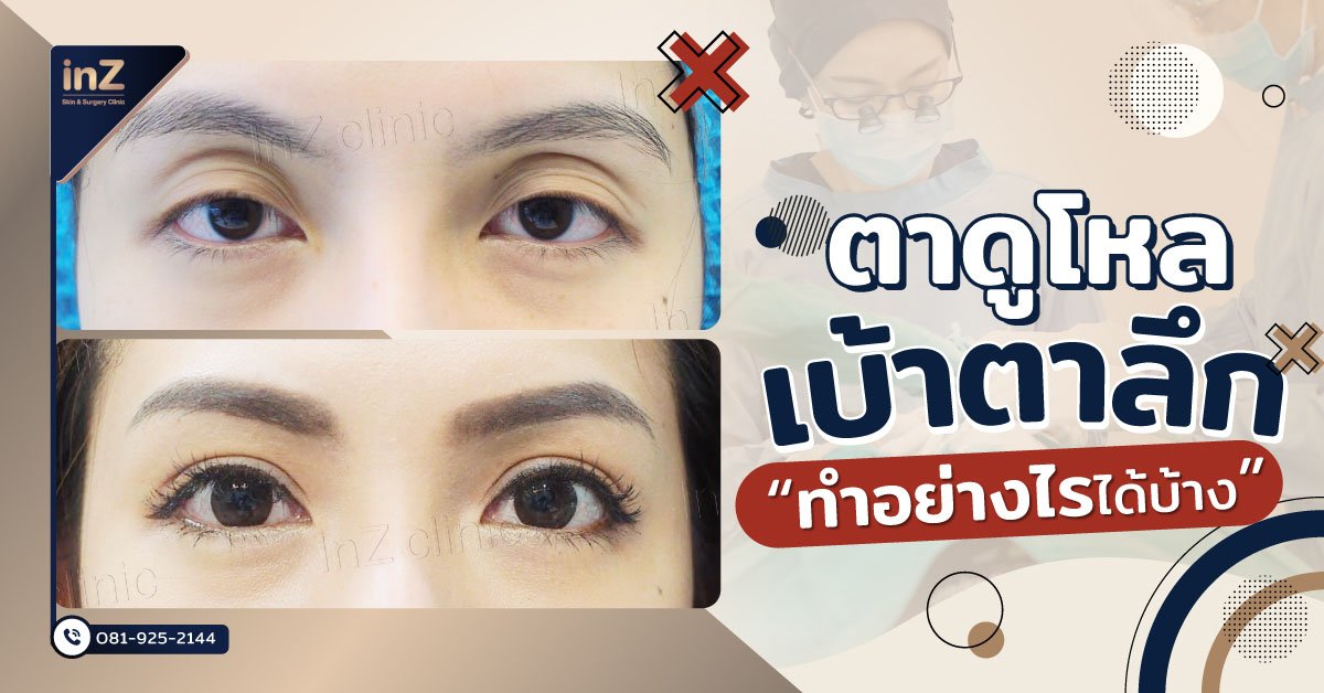 ปัญหาตาโหล เบ้าตาลึก แก้ไขอย่างไรดี