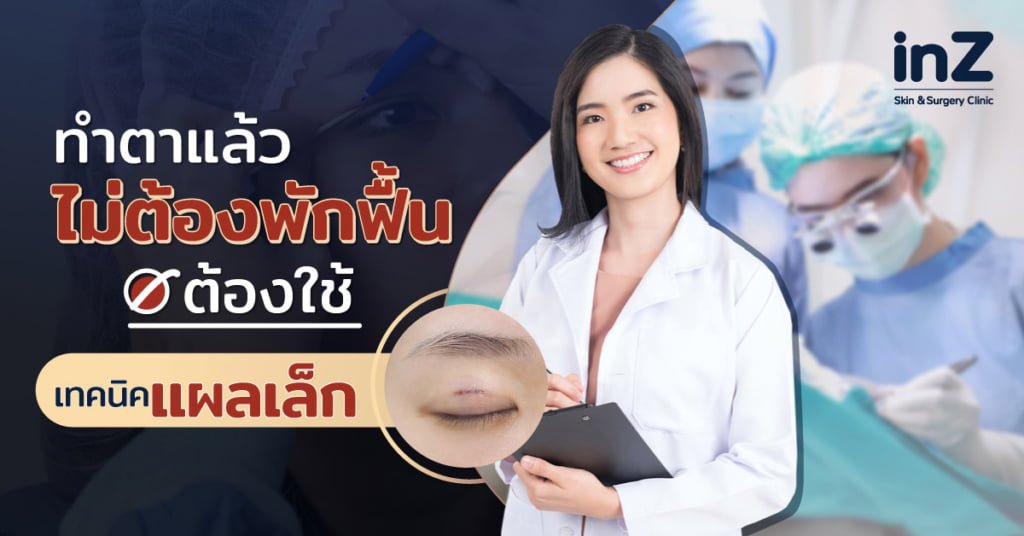 อยากทำตาแล้วไม่ต้องพักฟื้น ต้องใช้เทคนิค