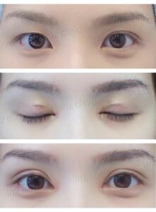 เปิดหัวตา