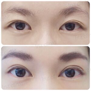 เปิดหัวตา