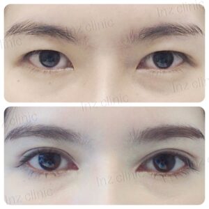 เปิดหัวตา