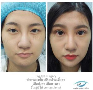 เปิดหัวตา
