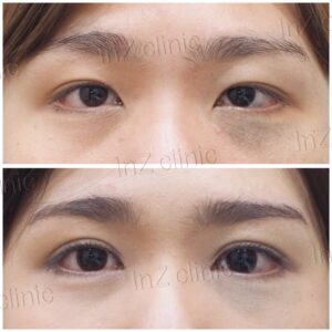 เปิดหัวตา