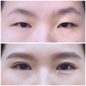 เปิดหัวตา