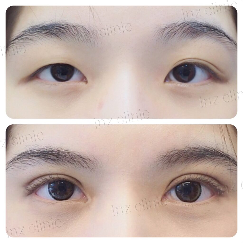 เปิดหัวตา_03