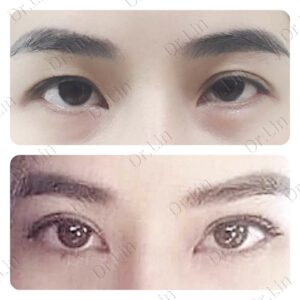 เปิดหัวตา
