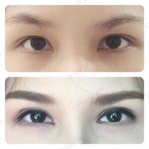เปิดหัวตา