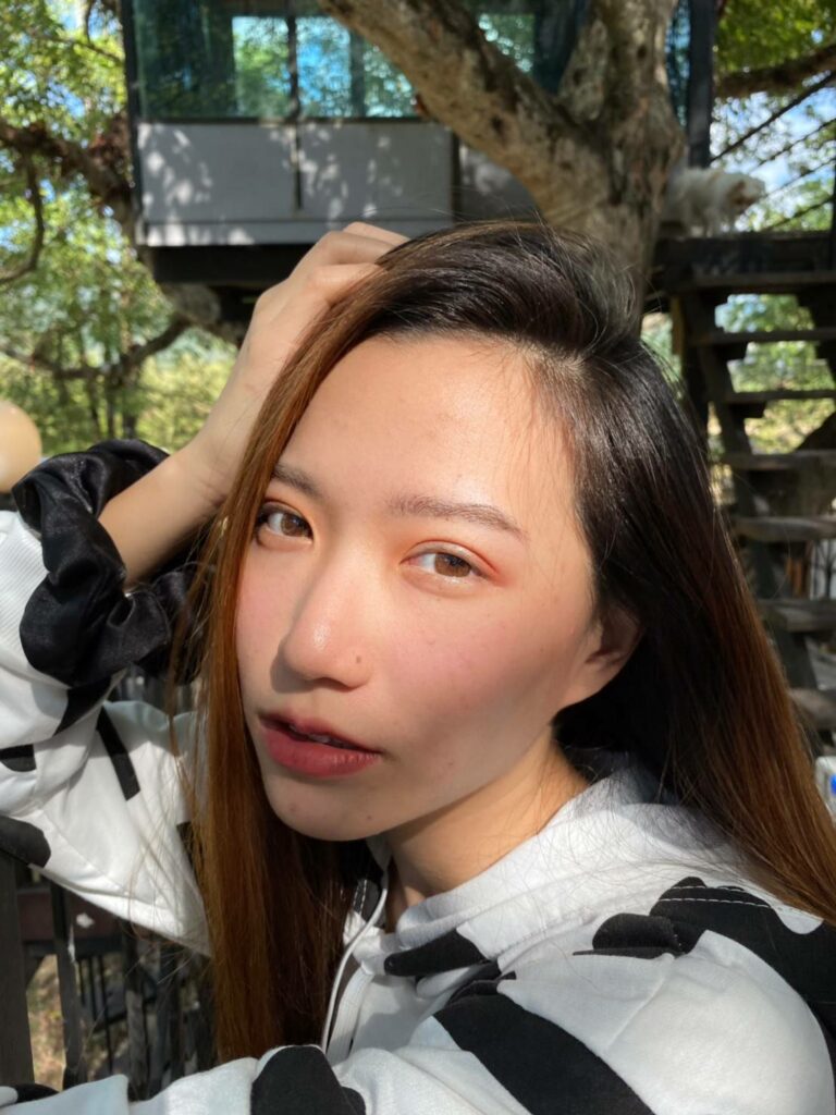 รีวิวทำตาสองชั้น_คุณปอม_แผลเล็ก04