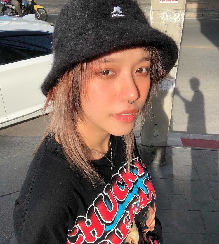 รีวิวทำตาสองชั้น_คุณฟ้า_Big_eye_surgery04