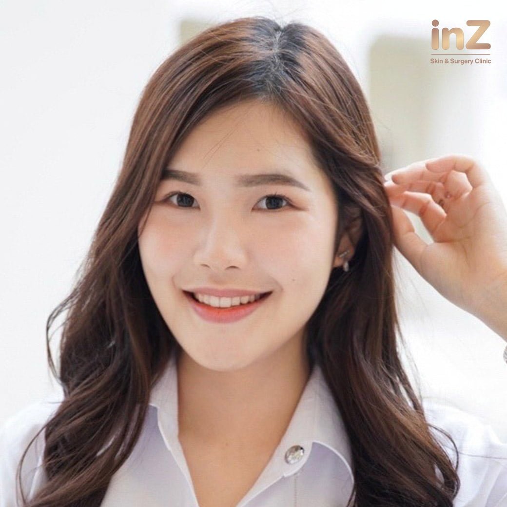 ทำตาสองชั้น_ทีมจักษุแพทย์_Inz_Clinic_51