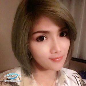 ศัลยกรรมตาโต_เย็บกล้ามเนื้อตา_50