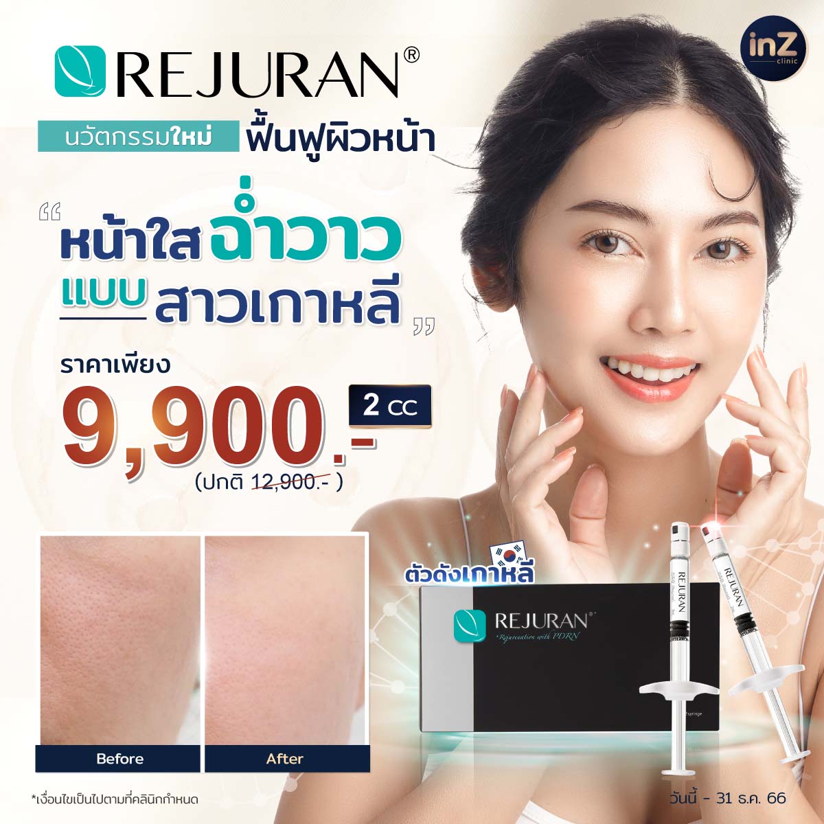 โปรโมชั่นรีจูรัน