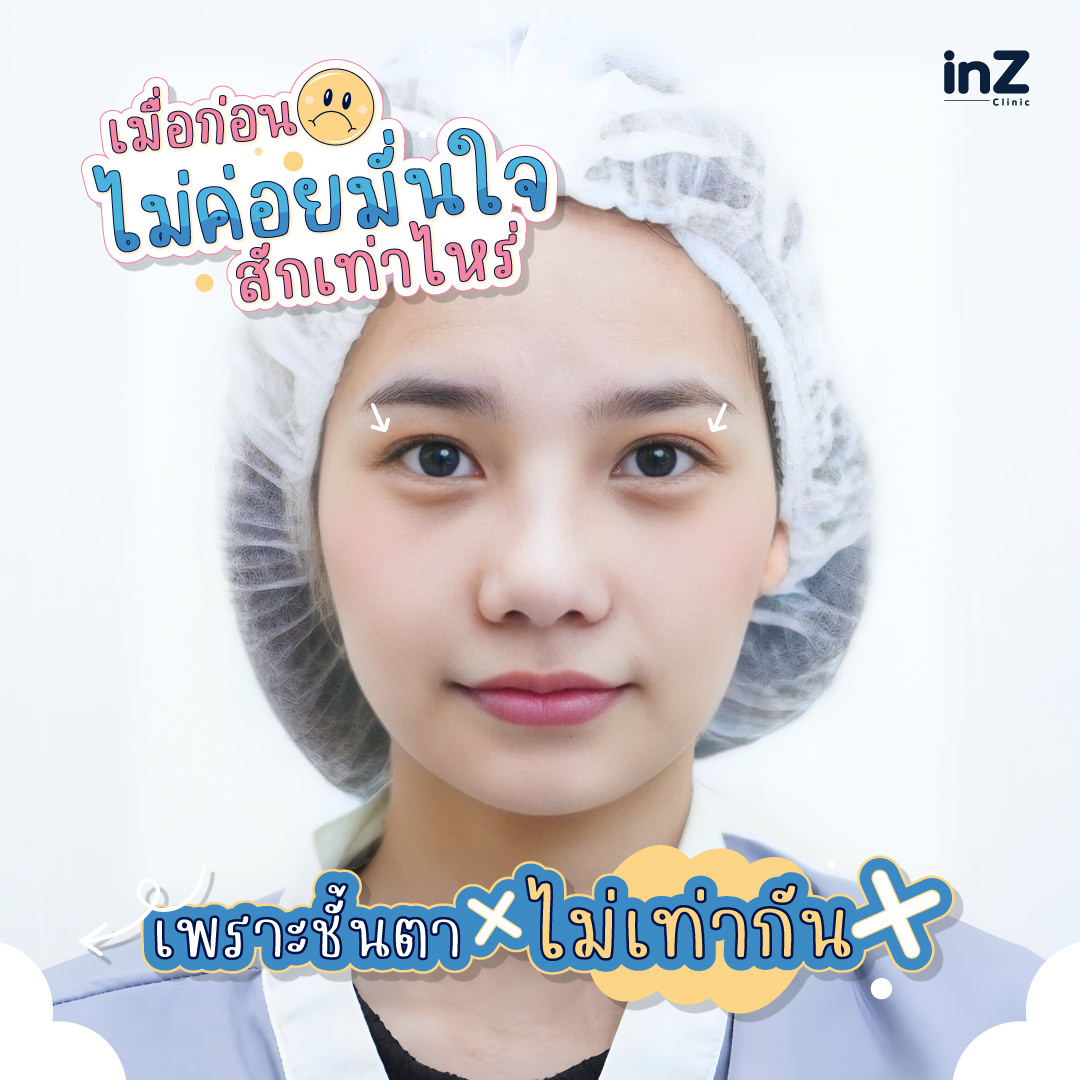 คุณน้ำมนต์ - inZ Clinic