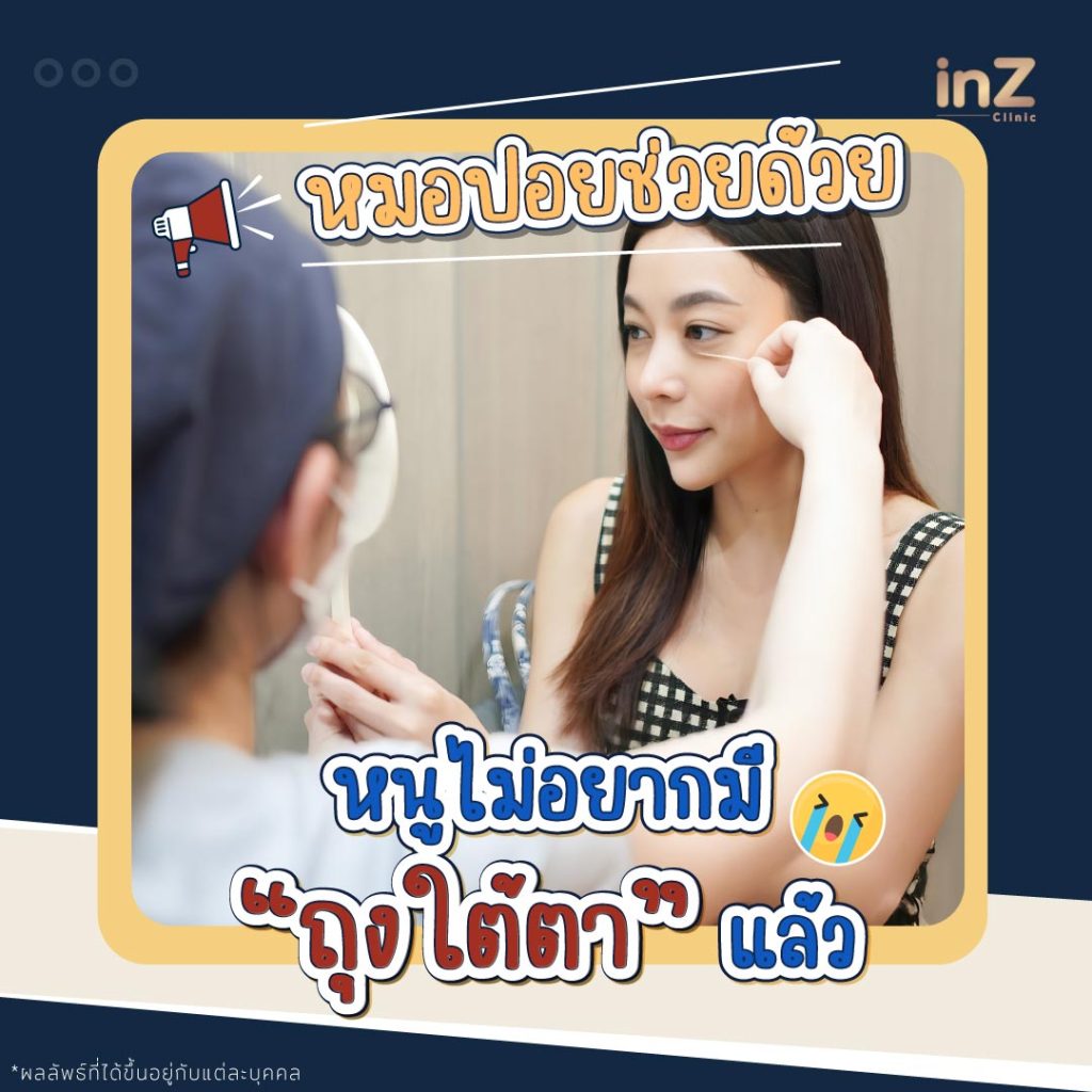 กำจัดถุงใต้ตา