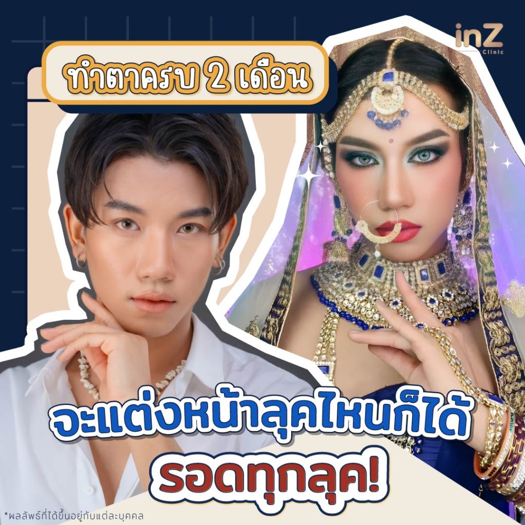 ตาสองชั้นหลังทำ 2 เดอือน