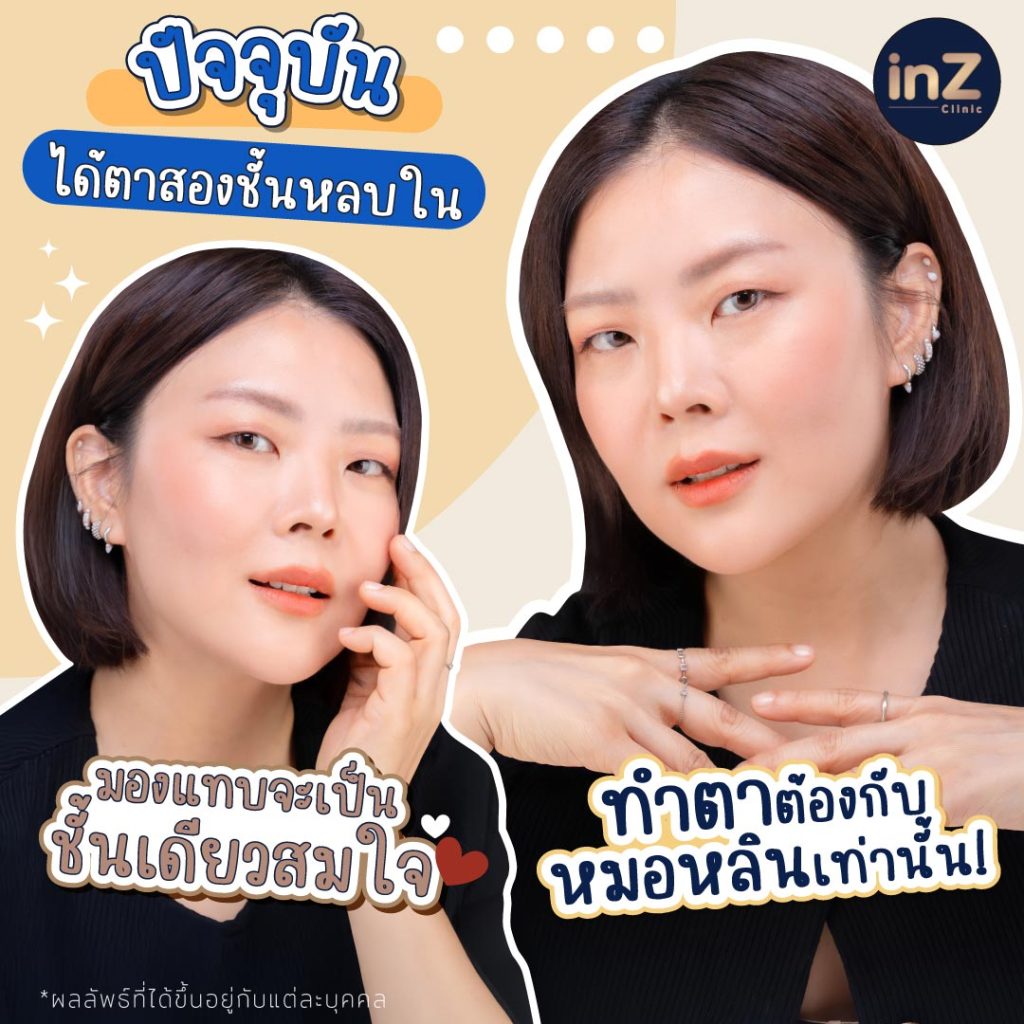 ลุลาทำตาสองชั้นกับหมอหลิน ที่ inZ Clinic