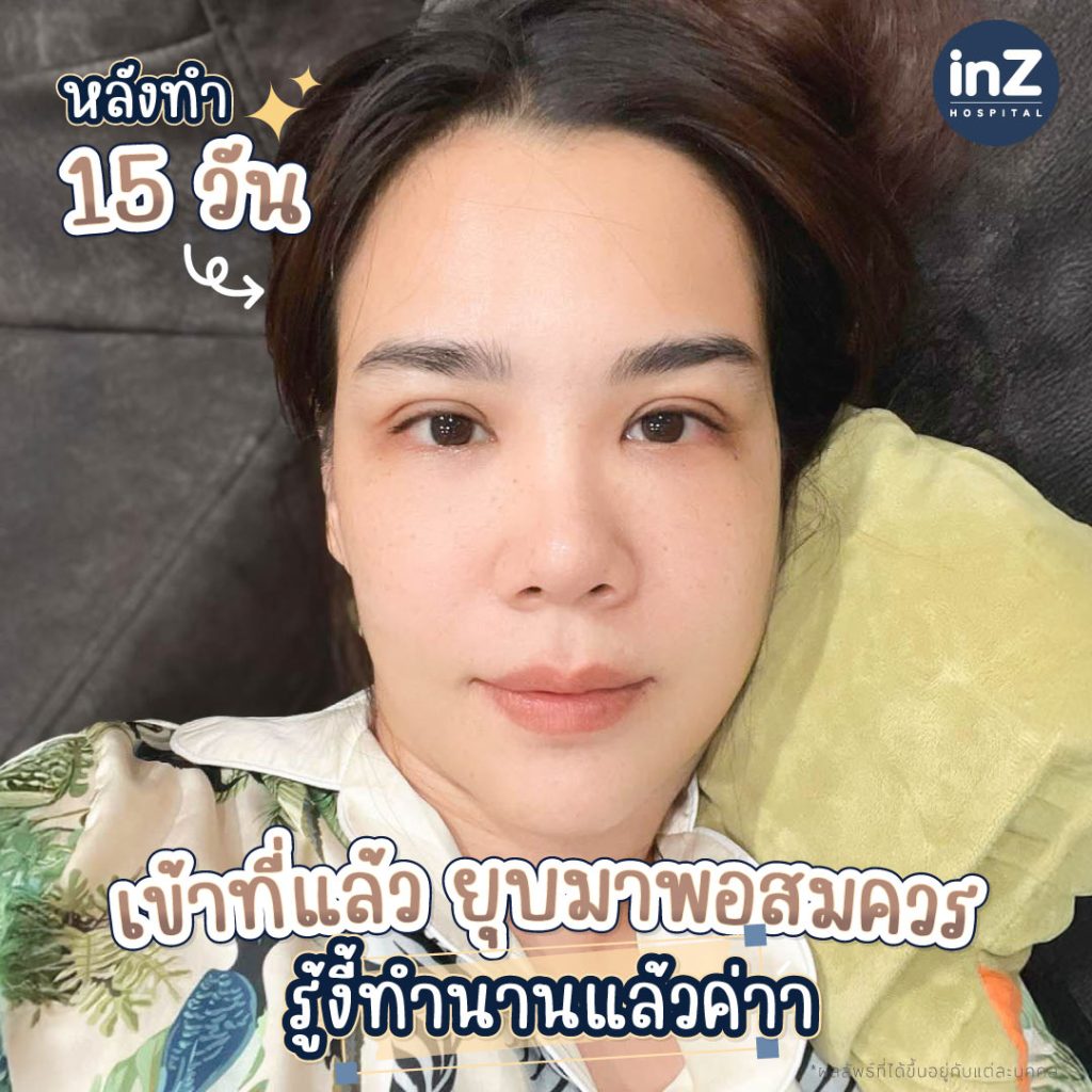 คุณกวาง อภิญญา