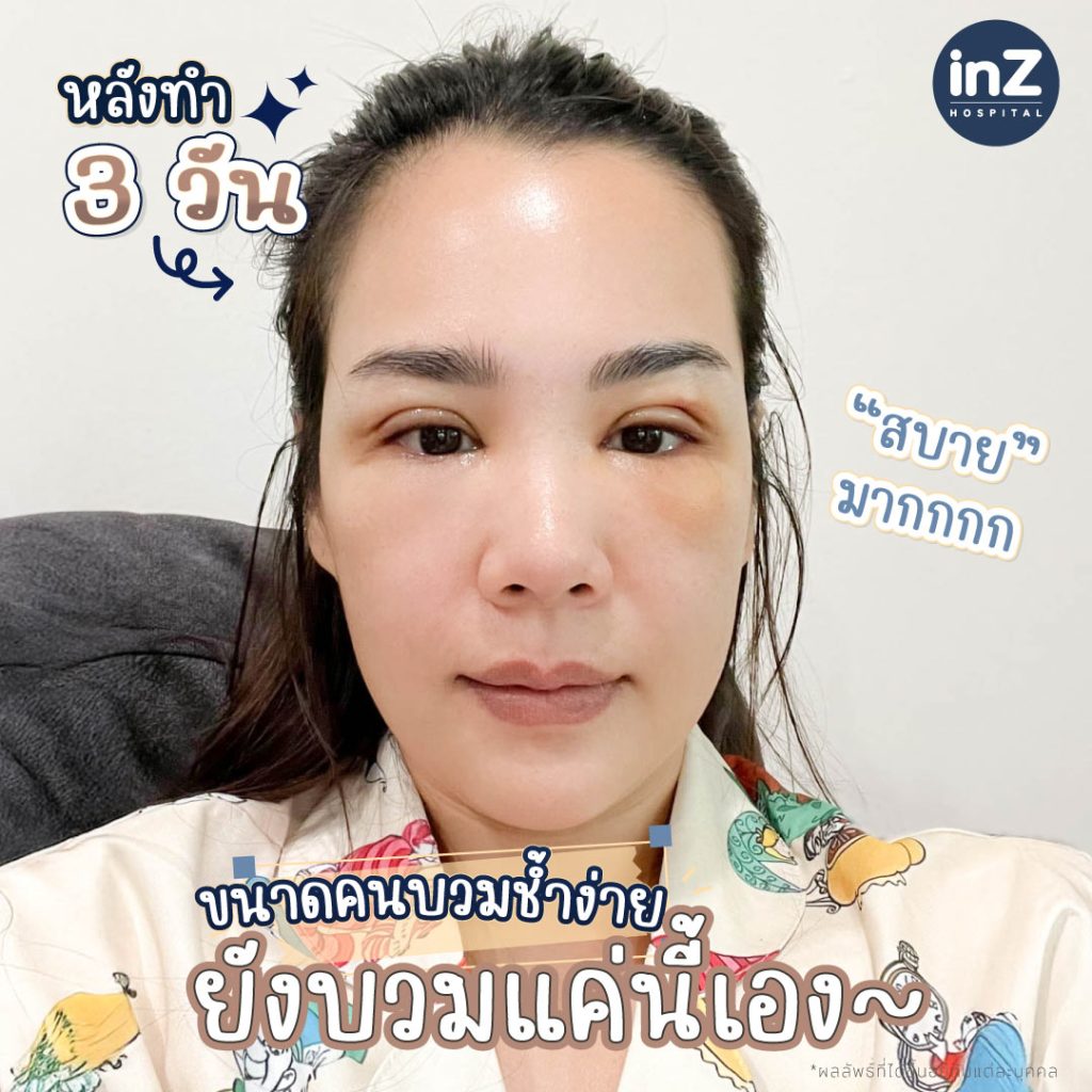 คุณกวาง อภิญญา