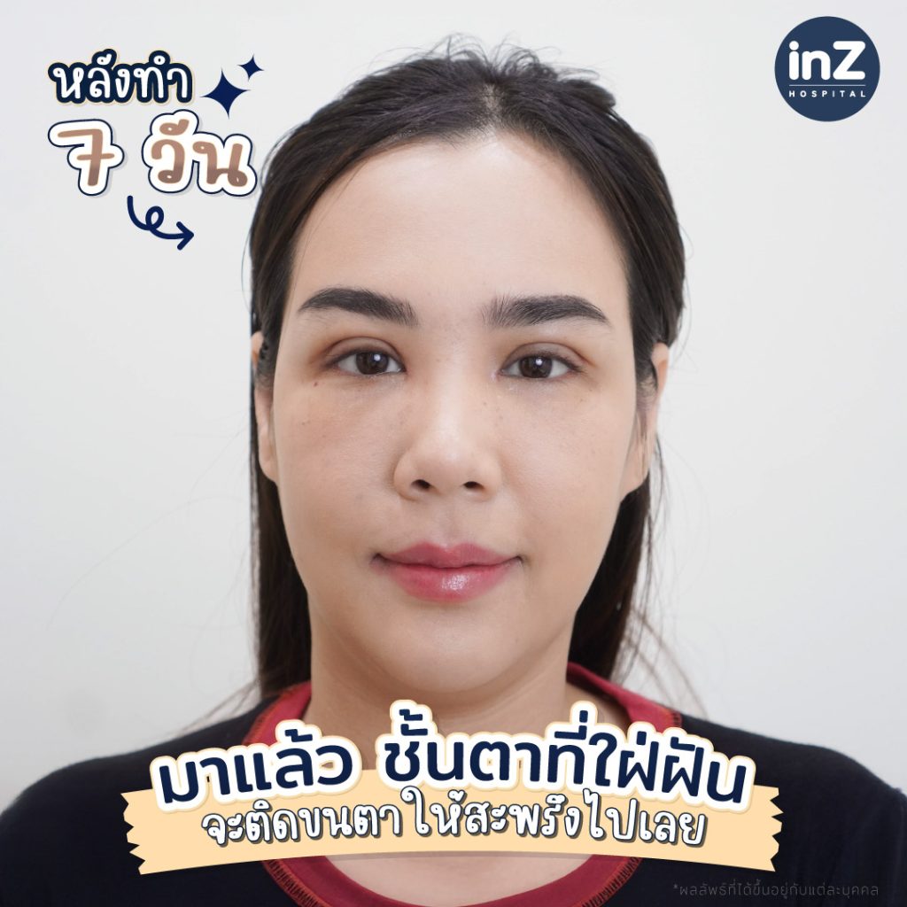 คุณกวาง อภิญญา