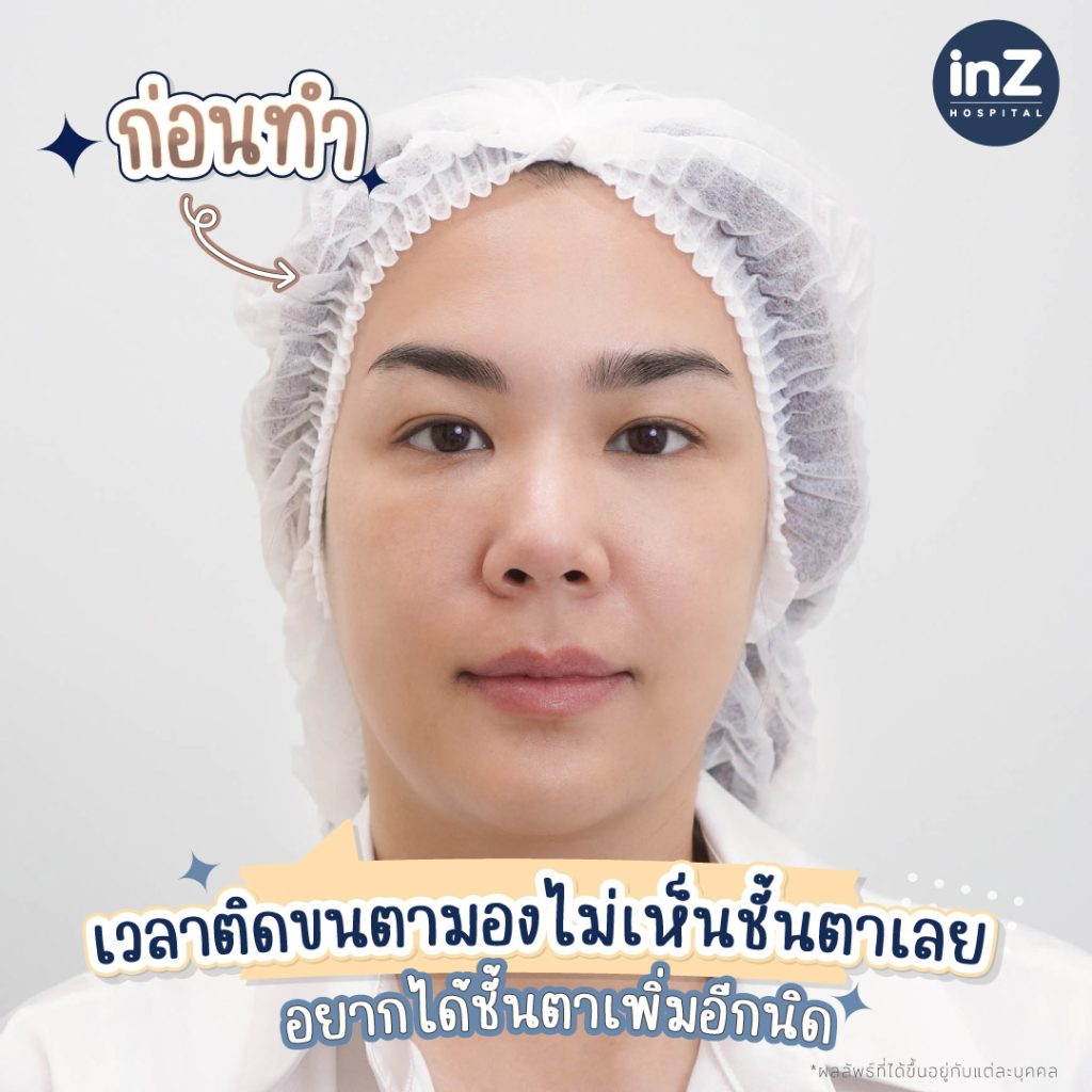 คุณกวาง อภิญญา