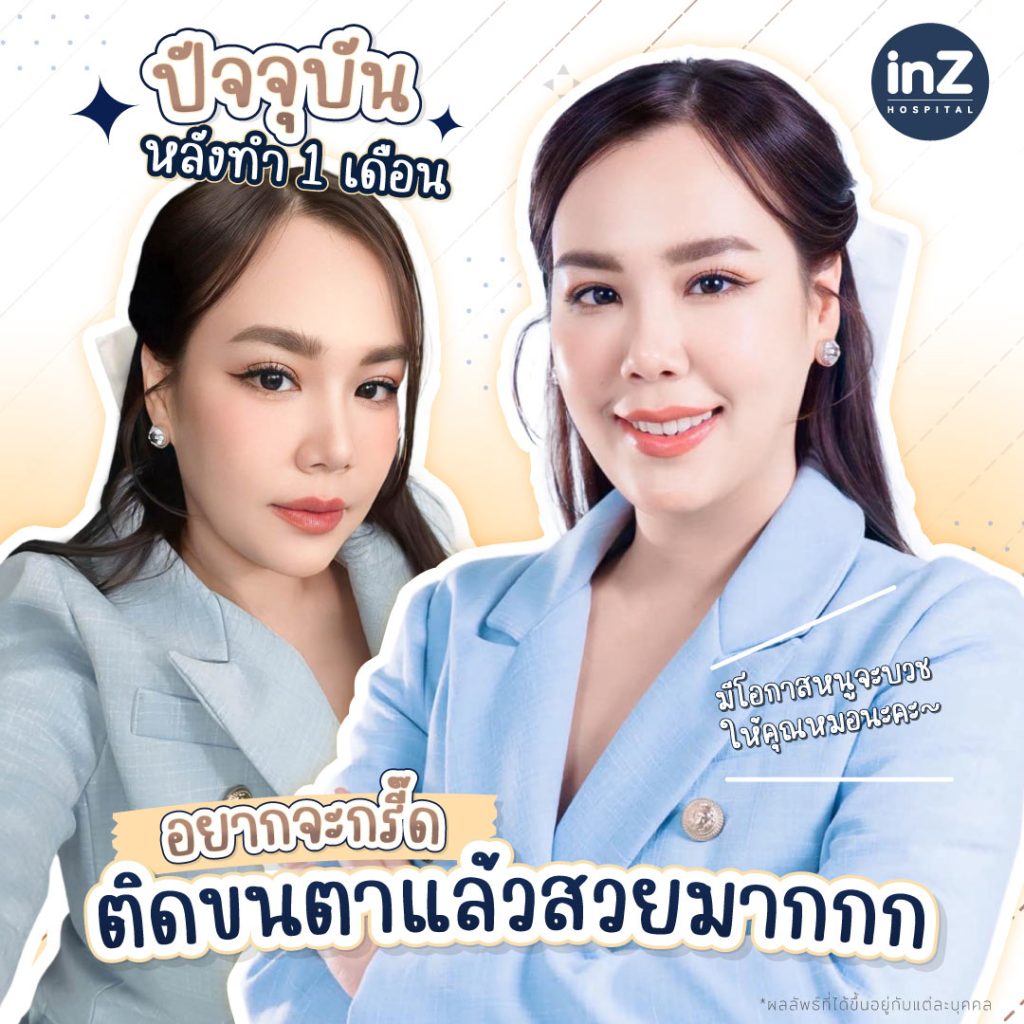 คุณกวาง อภิญญา