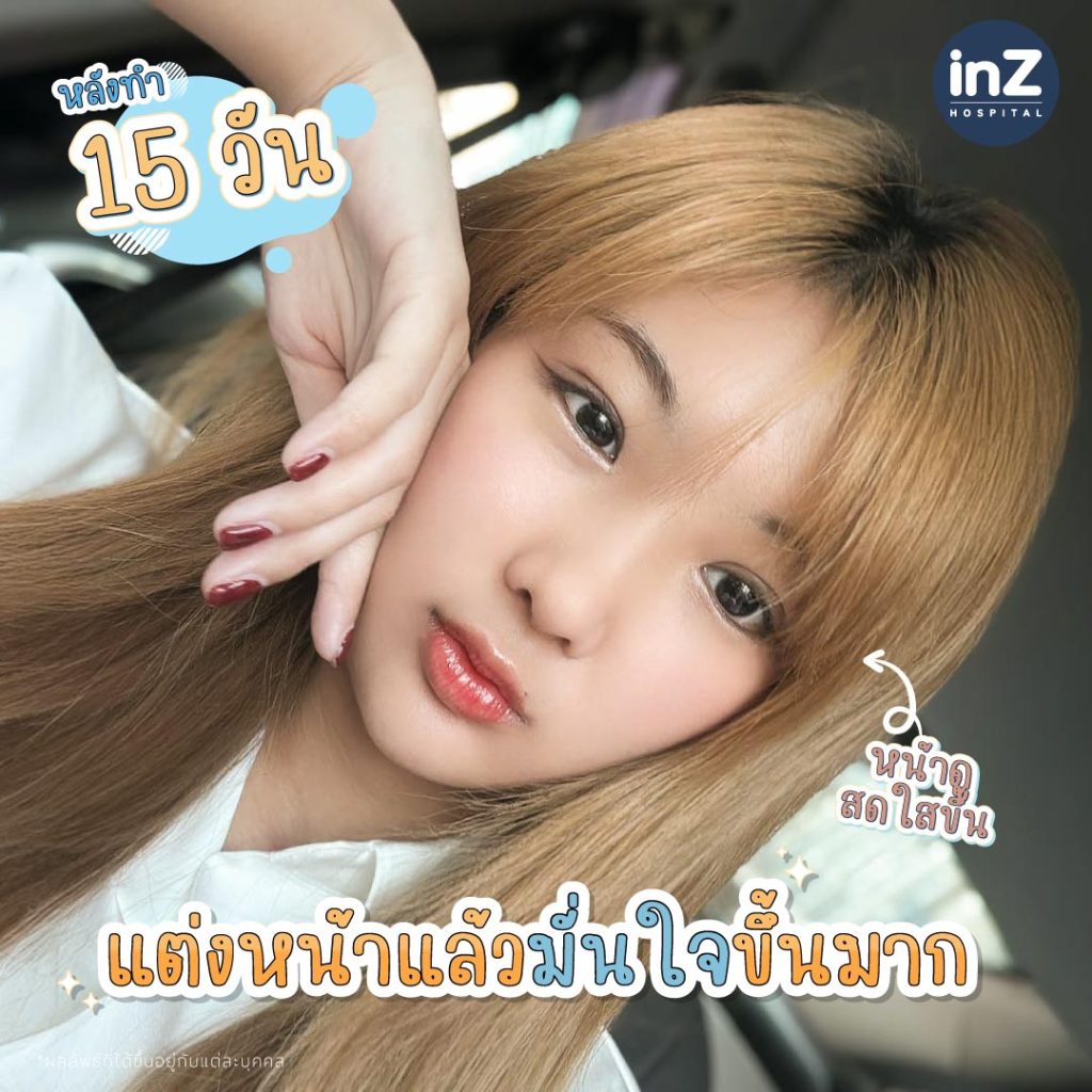 คุณโบว์ลิ่ง ณัฐพัชร์