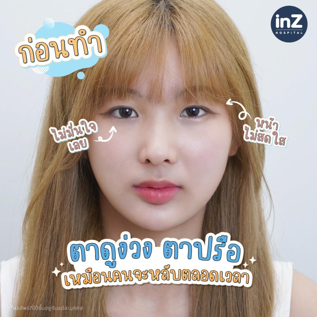 คุณโบว์ลิ่ง ณัฐพัชร์