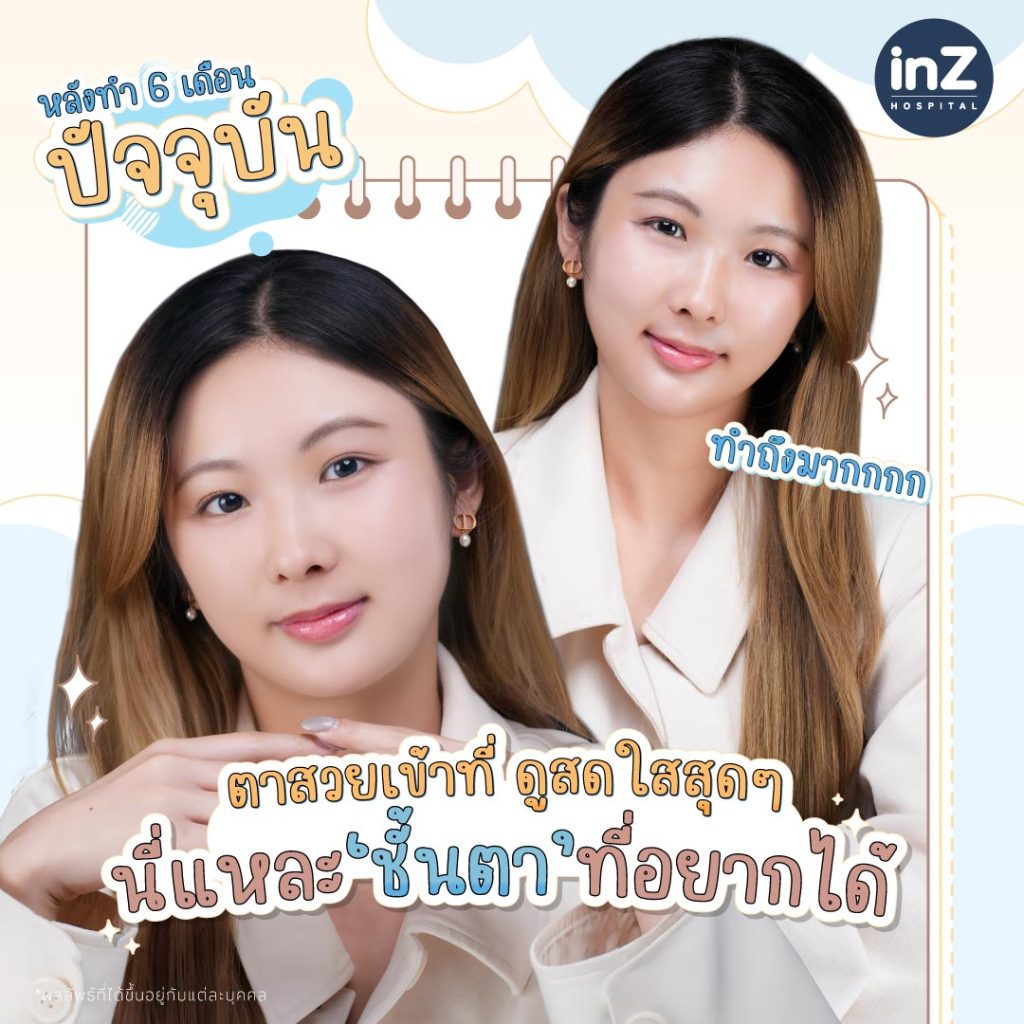 คุณโบว์ลิ่ง ณัฐพัชร์