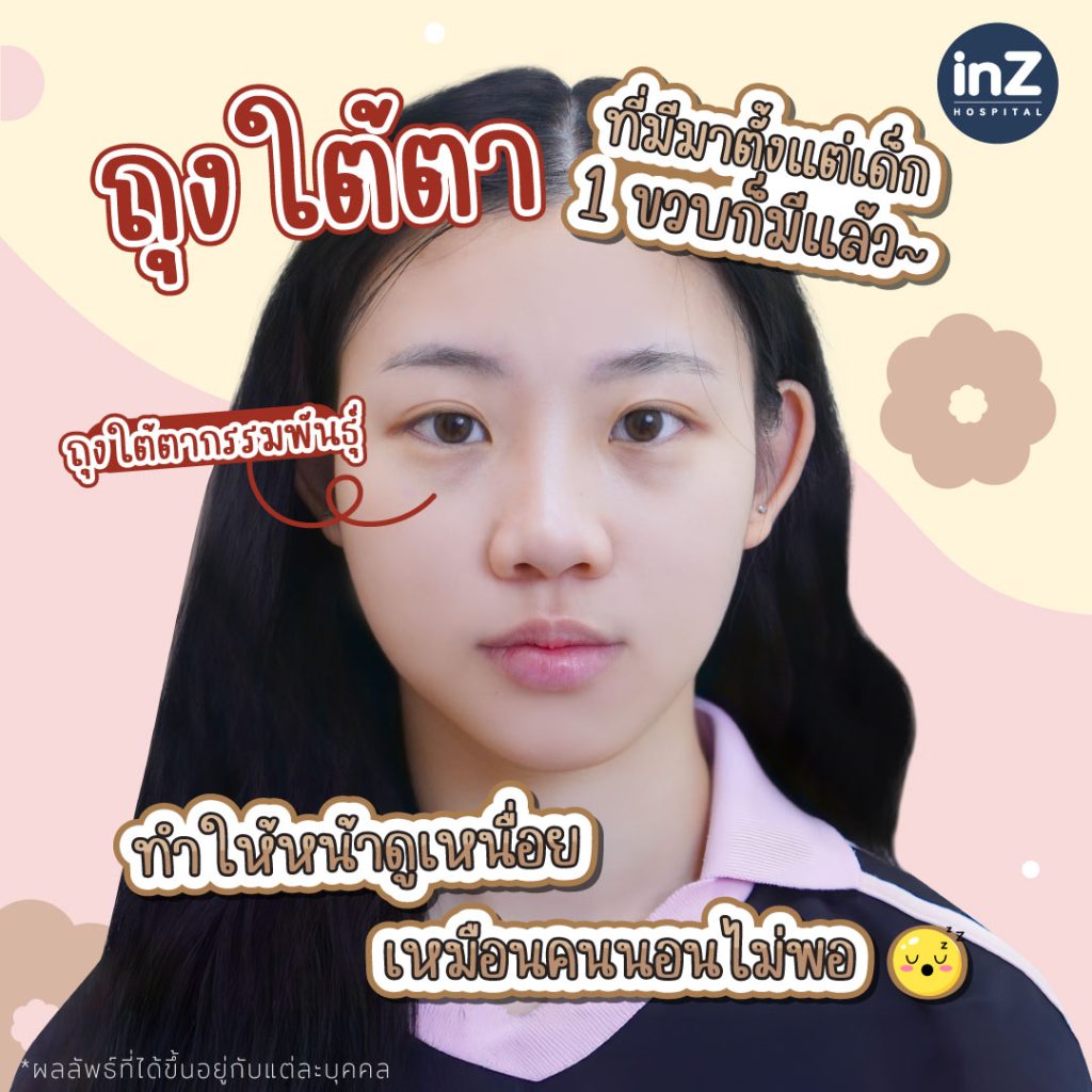 คุณพิม พิมพ์พิชชา