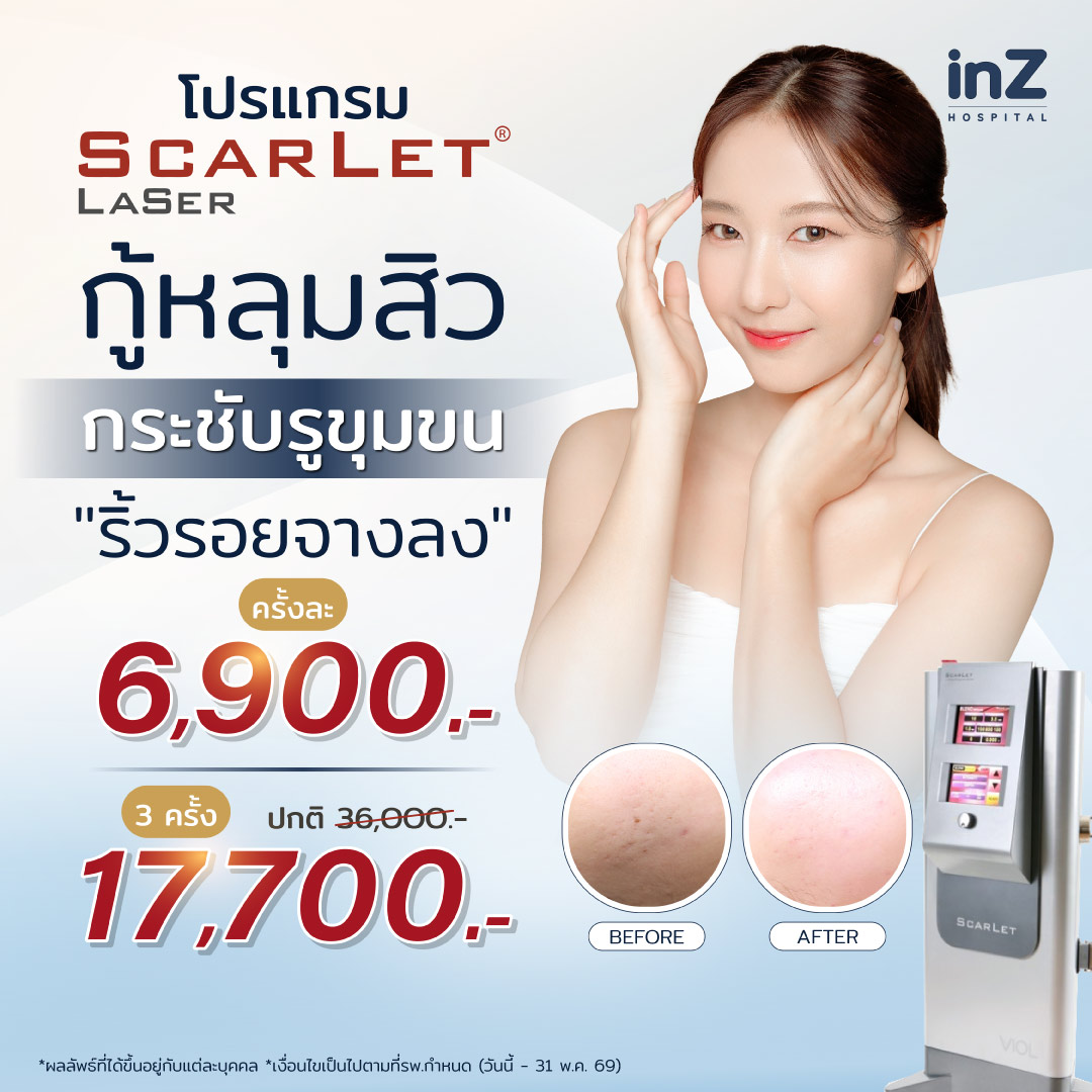 Scarlet Laser ฟื้นฟูริ้วรอย หลุมสิว เผยผิวเรียบเนียน